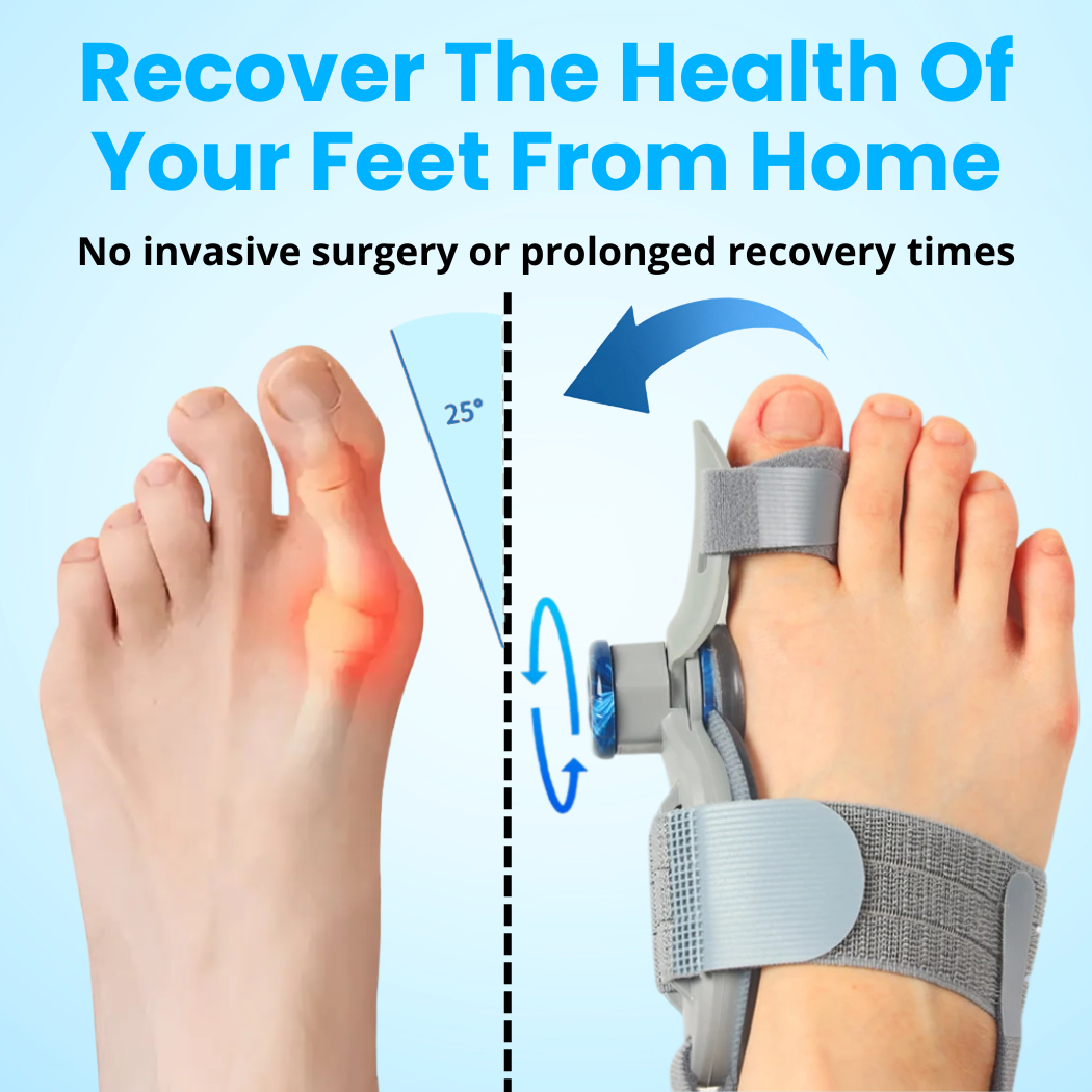 BuniFix™ - Non-Surgical Relief for Bunion Pain