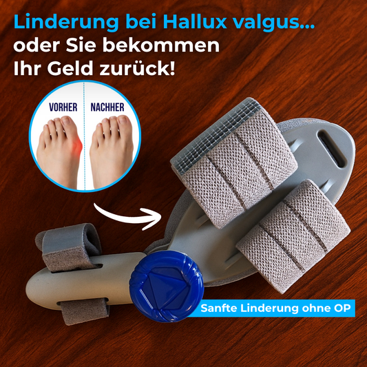 BuniFix™ Bunion Fix