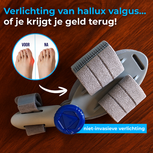 BuniFix™ Bunion Fix